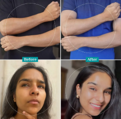 25% AHA, 2% BHA, 5% PHA Peeling Solution | Exfoliant For Radiant, Even-Toned Skin